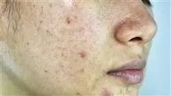 ##IMAGE##
