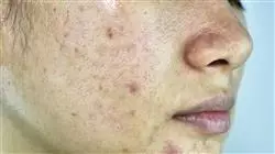 ##IMAGE##