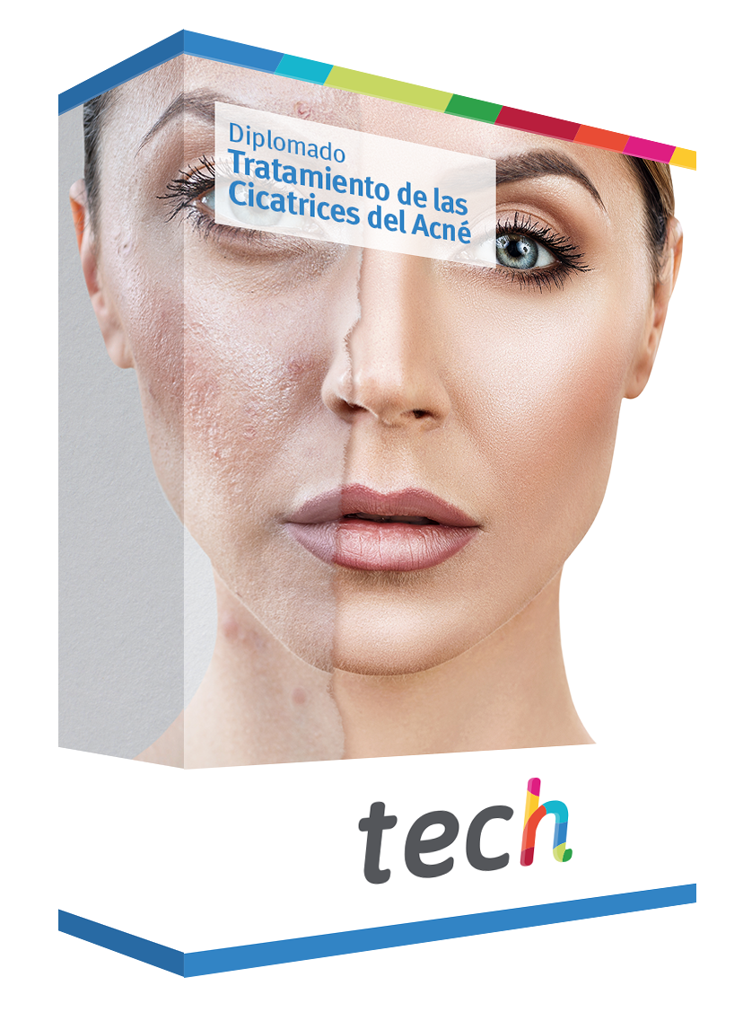 diplomado tratamiento cicatrices acne caja
