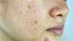 ##IMAGE##