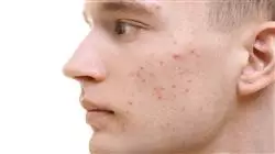 ##IMAGE##