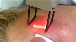 ##IMAGE##
