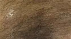 ##IMAGE##