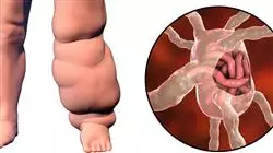 ##IMAGE##