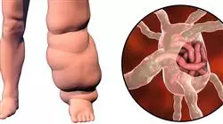 ##IMAGE##