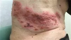 ##IMAGE##