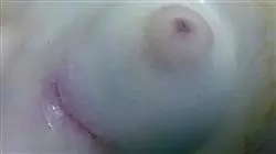 ##IMAGE##