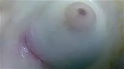 ##IMAGE##