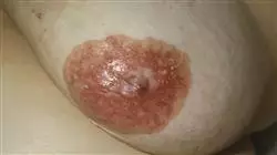 ##IMAGE##
