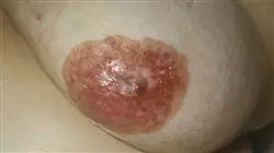 ##IMAGE##
