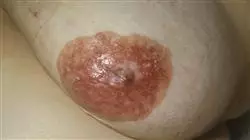 ##IMAGE##