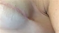 ##IMAGE##