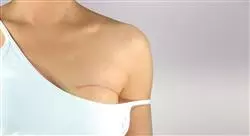diplomado cirugía plástica y reconstructiva de mama