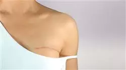 ##IMAGE##