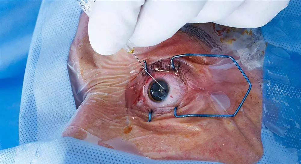cursos cirugía oftalmológica