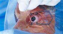 cursos cirugía oftalmológica