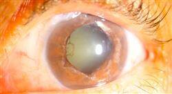 estudiar cirugía oftalmológica