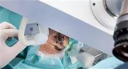 experto cirugía oftalmológica