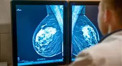 magister mastología aplicada y tratamiento del cáncer de mama