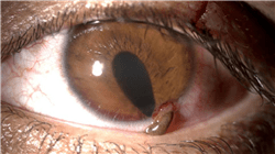 curso online ocular pathologies treatment