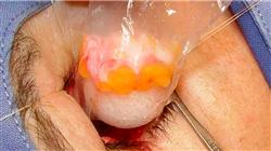 posgrado patologias oculares tratamiento