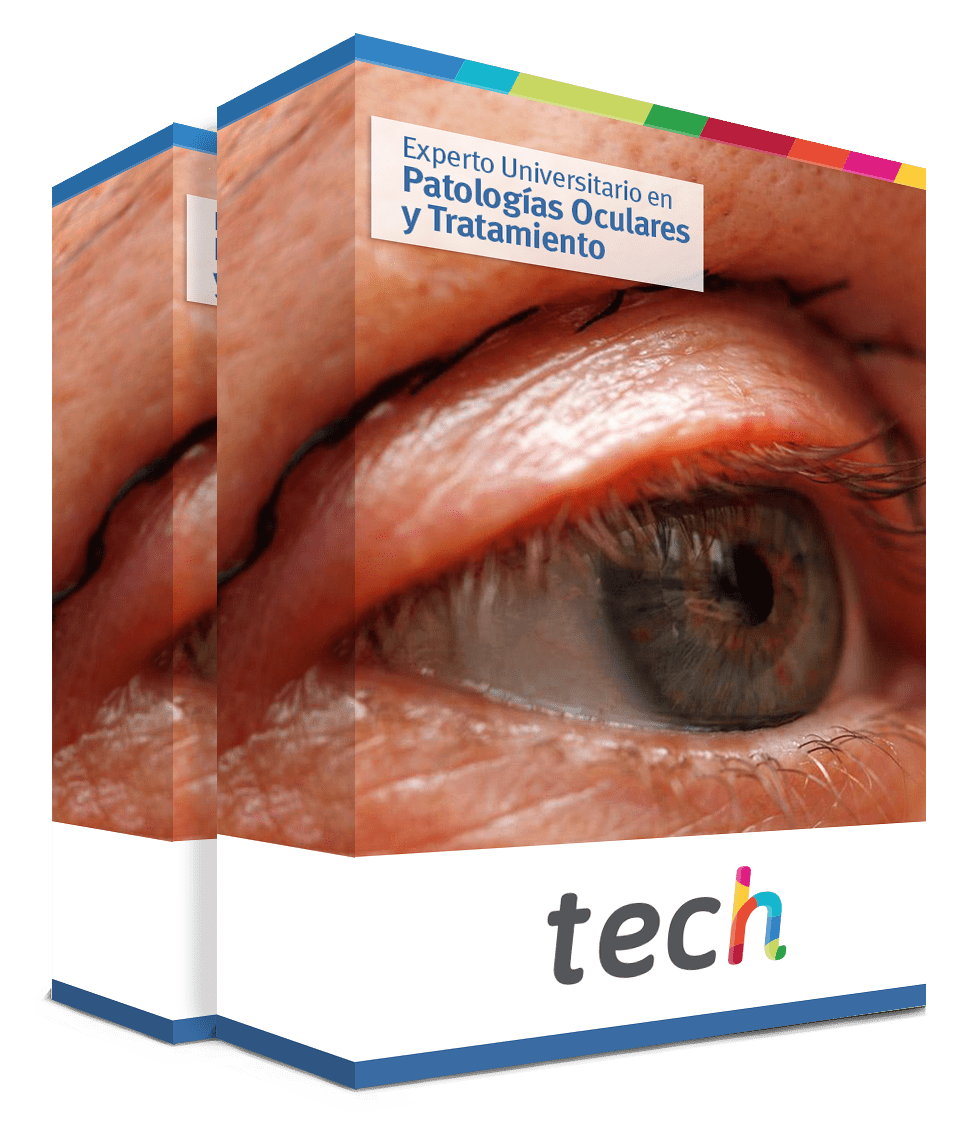 especializacion patologias oculares tratamiento caja