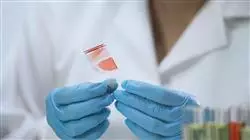 curso online actualizacion pruebas coagulacion trombosis fibrinolisis