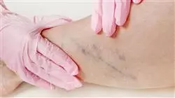 diplomado online actualizacion pruebas coagulacion trombosis fibrinolisis