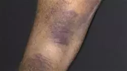 ##IMAGE##