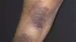 ##IMAGE##