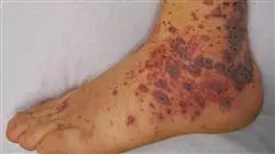 ##IMAGE##