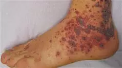 ##IMAGE##