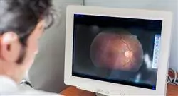 experto universitario uveítis y retina