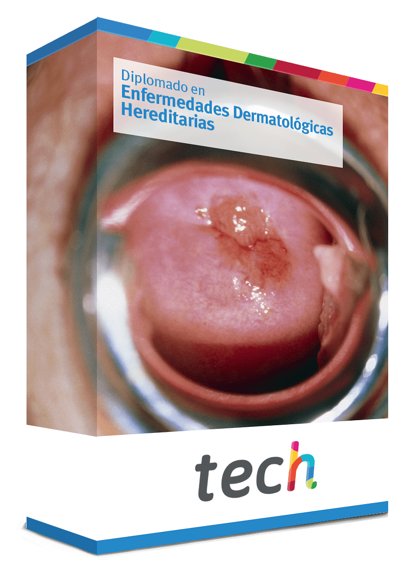 diplomado enfermedades dermatologicas hereditarias caja