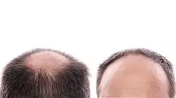 ##IMAGE##
