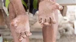 ##IMAGE##