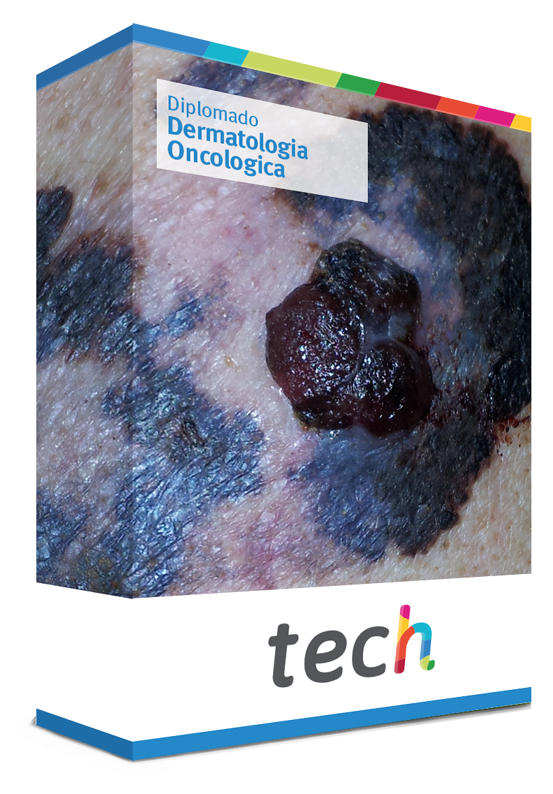 diplomado dermatologia oncologica caja