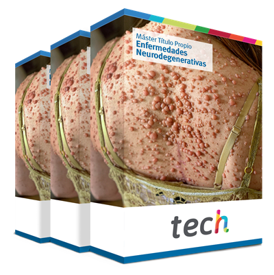 maestria enfermedades neurodegenerativas caja