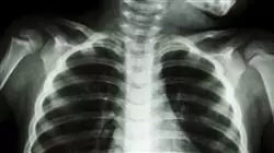 ##IMAGE##