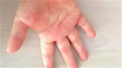 ##IMAGE##