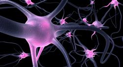 formacion trastornos neurodegenerativos producidos por priones