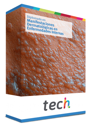 diplomado manifestaciones dermatologicas enfermedades internas caja