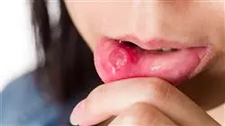 ##IMAGE##