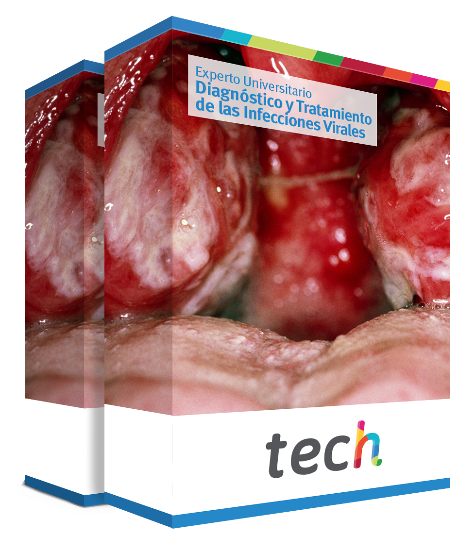especializacion diagnostico tratamiento infecciones virales caja