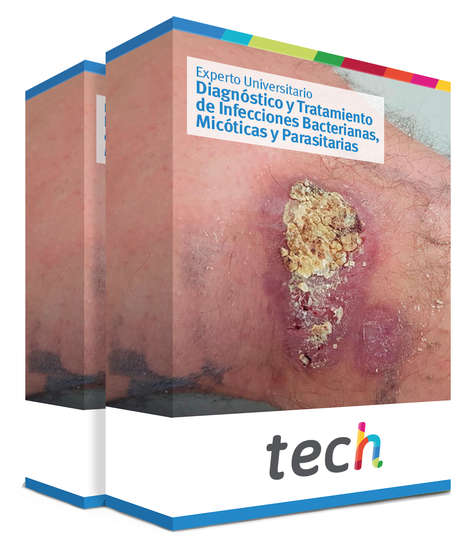 especializacion diagnostico tratamiento infecciones bacterianas micoticas parasitarias caja