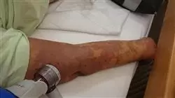 ##IMAGE##