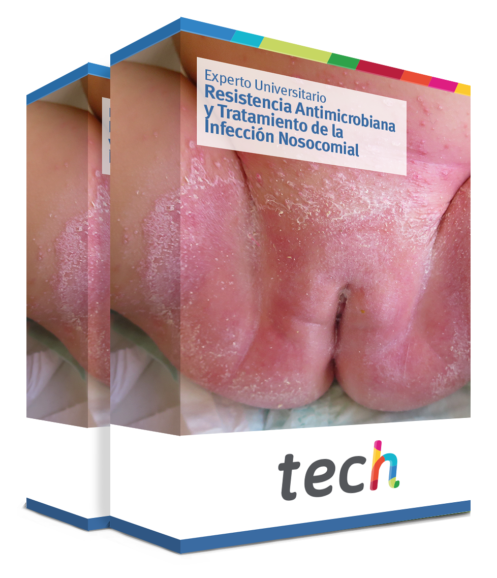 especializacion resistencia antimicrobiana tratamiento infeccion nosocomial caja