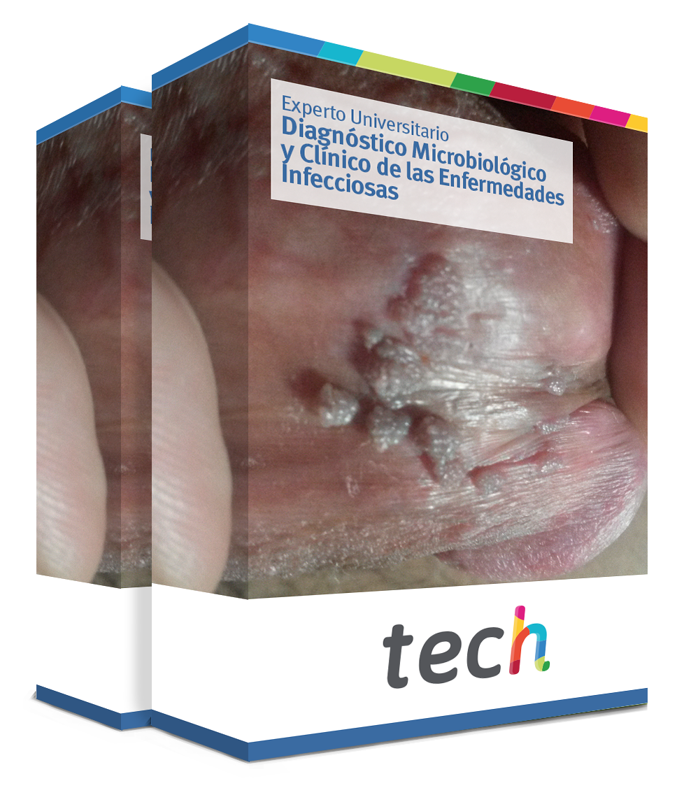 especializacion diagnostico microbiologico clinico enfermedades infecciosas caja
