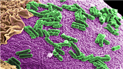  formaciion metodo clinico infecciosas