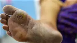 ##IMAGE##